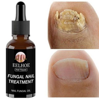 발톱 셀라큐어 네일 조갑사상균증 리페어, 상세페이지 참고, 30ml