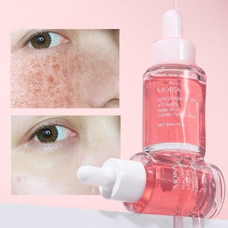 검버섯 미백기미 잡티 나이아신아마이드 멜라닌 색소 완화 히알루론산 수분 보습 세럼 감소 여드름 자국을, 2개, 30ml