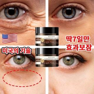 눈밑지방재배치 비 지방 육아종 제거 크림 주름과 다크 서클을위한 아이 크림 콜라겐 눈밑지방, 2개, 50ml