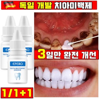[3일만 효과보장] 독일 1/1+1 셀프 치아미백제 세럼 화이트닝 플라크 치아 클렌징 얼룩 제거 사은품 랜덤 증정, 1개, 10ml