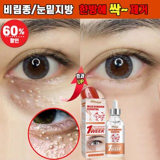 다이코쿠드럭스토어눈크림으로 문제 해결하기