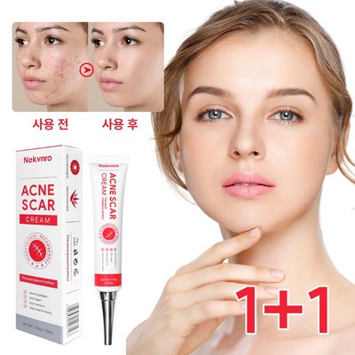 재생크림 여드름리페어연고 색소침착 여드름흉터 수술흉터 피지케어크림, 2개, 30g_부드럽고 고소한 맛