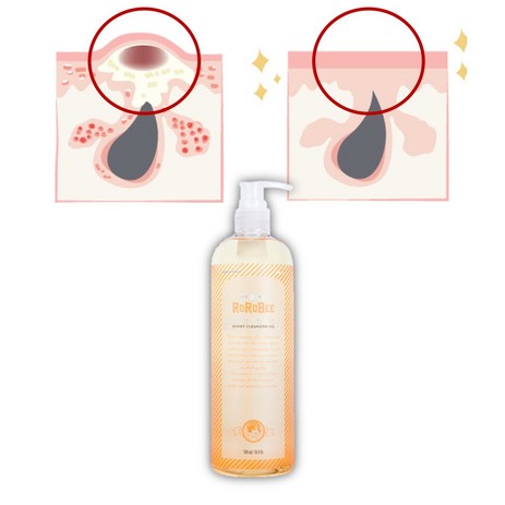 피지녹이는제품-피지제거액-모공각화증-스크럽-각질용해제-피지-녹이는오일-알갱이-귀블랙헤드-추천-상품