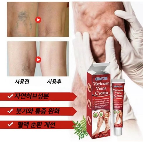 정맥주사연습 - [치료효과 99.99%] 빠른 치료 | 정맥류 | 혈관염 | 정맥류 통증 | 하지정맥류, 1개