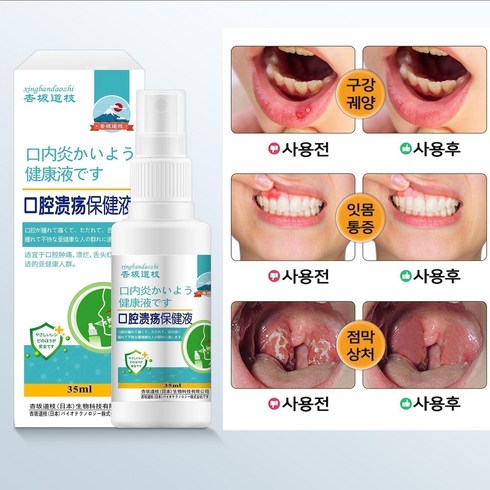 구내염약 - 구내염 스프레이 구강 염증 혀염증 구강 궤양 잇몸염 스프레이, 1개, 35ml