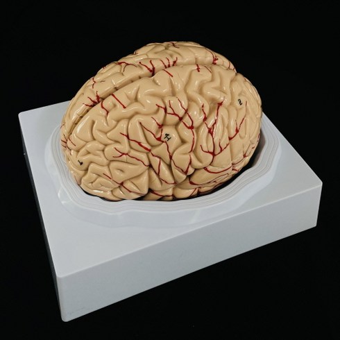 비르피츠 뇌모형
