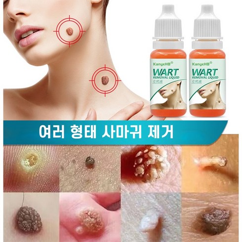 2023년 가성비 최고 사마귀제거제 - 얼굴 제거연고 쥐젖제거제 피부 바디태그, 10ml, 2개, 10ml