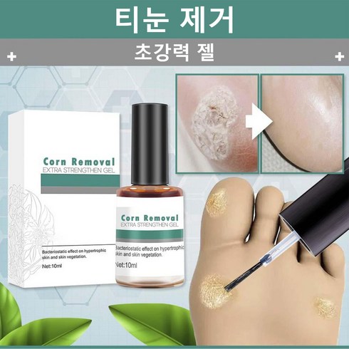 티눈약 - 1+1 발가락 편평사마귀 발바닥 10ML