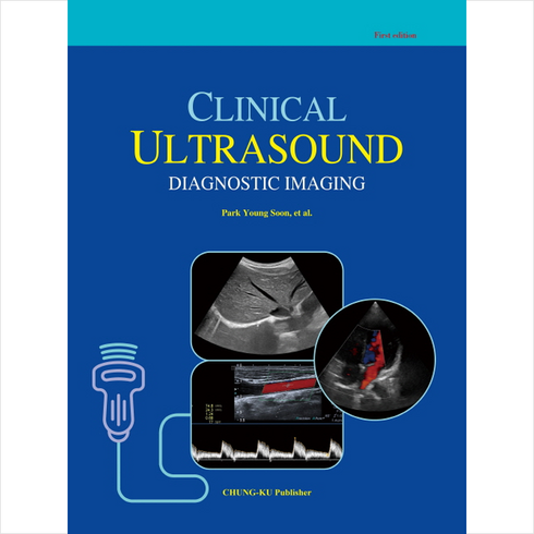ultrasound TOP01