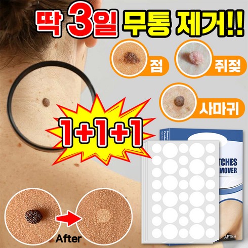 오똥새 - [빠른배송] 피부 제거 패치 얼굴 바디 피부 치료 라벨 스텔스 포장증정, 3개, 143개입