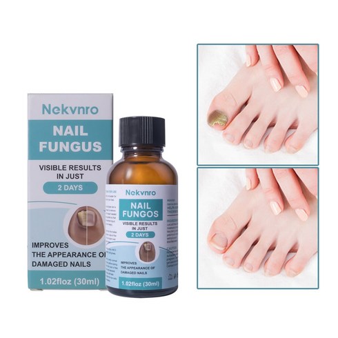 [케라셀네일] Nekvnro 발톱무좀 영양제 관리 앰플, 2개, 30ml