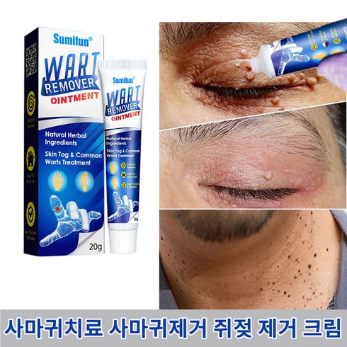 SUMIFUN 피부 치료 바디 라벨 신속하고 효과적인 치료하다 크림, 3개, 20g
