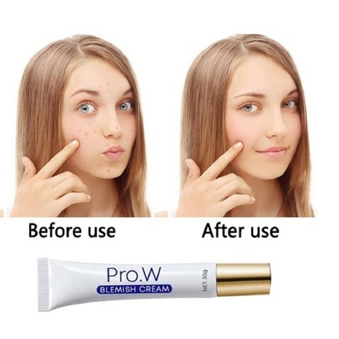 Pro.W 기미잡티크림 반점제거연고 여드 름 연고 흉터 자국 30g, 1개, 1개
