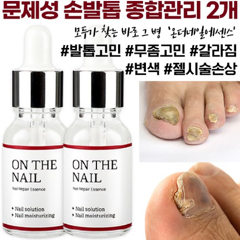 비비룩 온더네일 에센스, 18ml, 2개