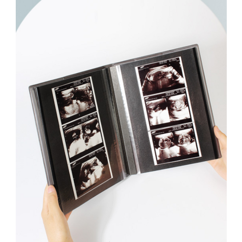 소중한 첫 만남, 리코즈 베베 초음파 앨범으로 영원히 간직하세요.