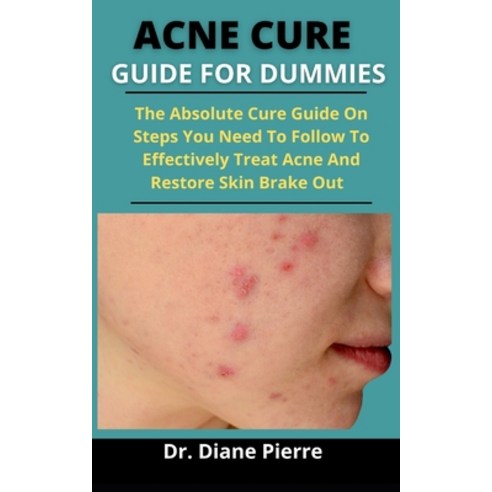 Acne Cure Guide For Dummies: The Absolute Cure Guide On Steps You Need To Follow To Effectively Trea... Paperback, Independently Published, English, 9798730802773