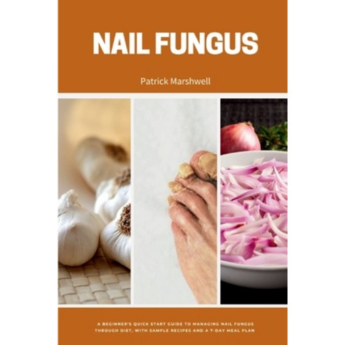 (영문도서) Nail Fungus: A Beginner''s Quick Start Guide to Managing Nail Fungus Through Diet With Sample... Paperback, Mindplusfood, English, 9798869215055