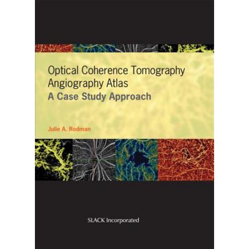 (영문도서) Optical Coherence Tomography Angiography Atlas: A Case Study Approach Hardcover, Slack, English, 9781630916411