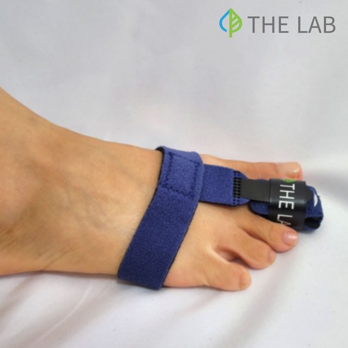 발가락 깁스로 발 건강을 되찾고 활기찬 일상으로!