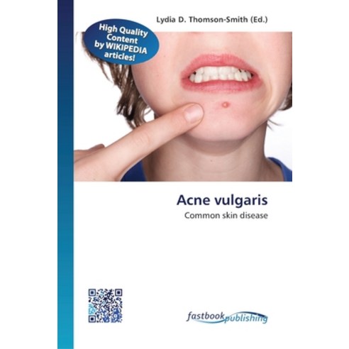 Acne vulgaris Paperback, Fastbook Publishing