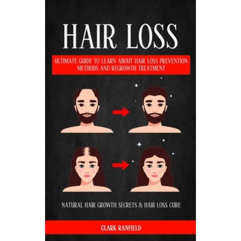 (영문도서) Hair Loss: Ultimate Guide To Learn About Hair Loss Prevention Methods And Regrowth Treatment ... Paperback, Darby Connor