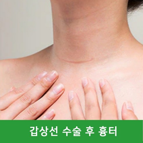 Mepiform, 흉터 고민, 이제는 옅어지게! 흉터, 흉터, Mepiform으로 관리하세요!