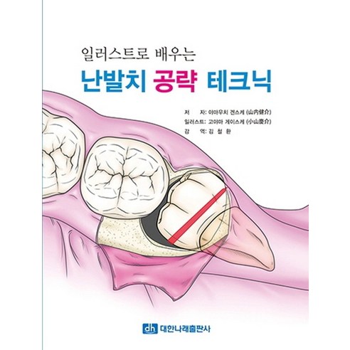 일러스트로 배우는 난발치 공략 테크닉, 대한나래출판사, 야마우치 겐스케,고야마 게이스케 저/김철환 역