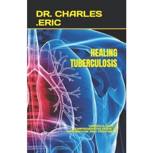 (영문도서) Healing Tuberculosis: Tuberculosis: A Comprehensive Guide to Prevention and Treatment Paperback, Independently Published, English, 9798399380285