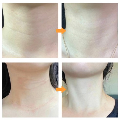 터메릭 넥 크림으로 숨겨진 1cm를 찾아 빛나는 자신감을!