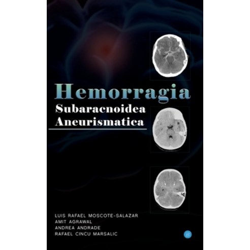 Hemorragia Subaracnoidea Aneurismatica Paperback, Bluerose Publishers Pvt. Ltd.
