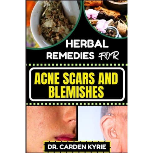 (영문도서) Herbal Remedies for Acne Scars and Blemishes: Key Insights for a Flawless Complexion focusin... Paperback, Independently Published, English, 9798871062173