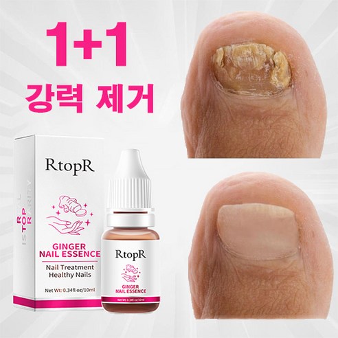 유오노미 독일 1+1 손발톱 발톱 관리 네일, 5개, 10ml