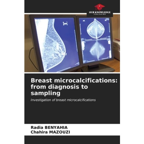 (영문도서) Breast microcalcifications: from diagnosis to sampling Paperback, Our Knowledge Publishing, English, 9786207035533