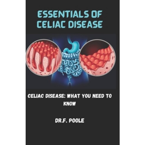 (영문도서) Essentials of Celiac Disease: Celiac Disease: What You Need to Know Paperback, Independently Published, English, 9798858565055