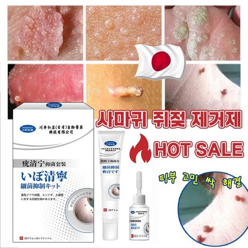 [국내배송] 제거제 얼굴 기미 제거 연고 점빼기 피부 치료 연고, 3개, 30g