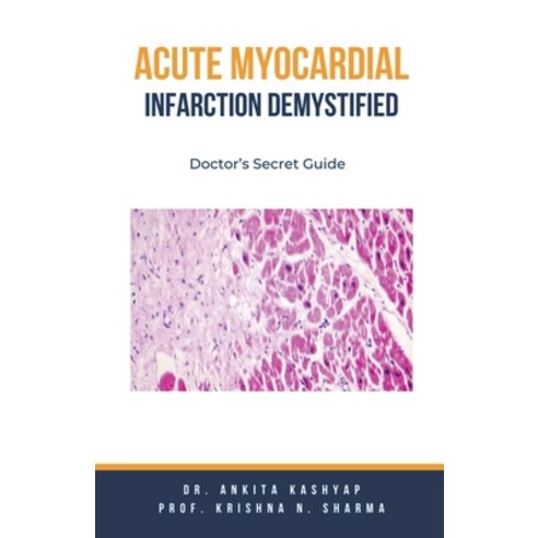 (영문도서) Acute Myocardial Infarction Demystified: Doctor''s Secret Guide Paperback, Virtued Press, English, 9798223047988