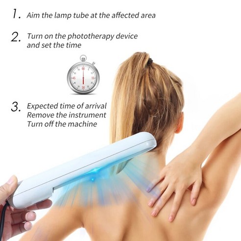 가정용 UV 백반증 광선 요법