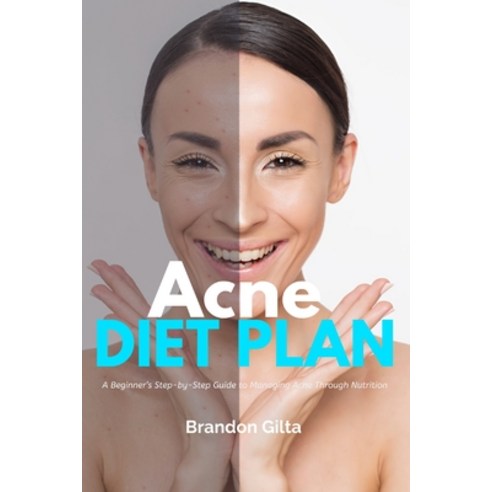 (영문도서) Acne Diet Plan: A Beginner''s Step-by-Step Guide to Managing Acne Through Nutrition With Curat... Paperback, Mindplusfood, English, 9798869134127