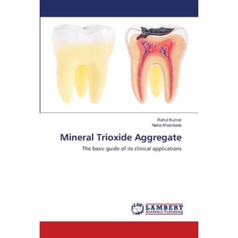 (영문도서) Mineral Trioxide Aggregate Paperback, LAP Lambert Academic Publis..., English, 9783659110153