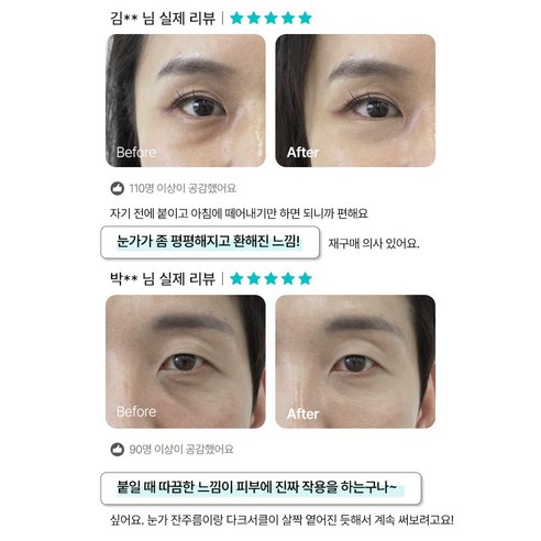 샤르드 아이패치 기대 효과