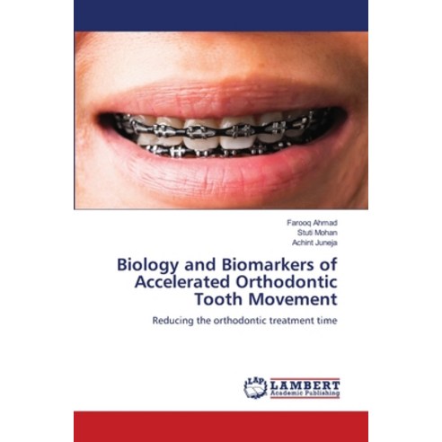 (영문도서) Biology and Biomarkers of Accelerated Orthodontic Tooth Movement Paperback, LAP Lambert Academic Publis..., English, 9786205633519
