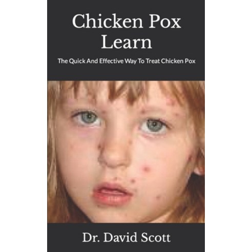 (영문도서) Chicken Pox Learn: The Quick And Effective Way To Treat Chicken Pox Paperback, Independently Published, English, 9798495909809