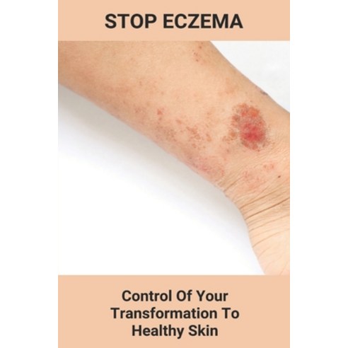 Stop Eczema: Control Of Your Transformation To Healthy Skin: Ear Eczema Treatment Paperback, Independently Published, English, 9798737822590