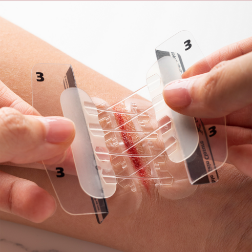 꿰매는 고통 없이, 흉터 걱정은 이제 그만! 서지너스 풀밴드 봉합키트로 간편하게 상처를 봉합하세요.