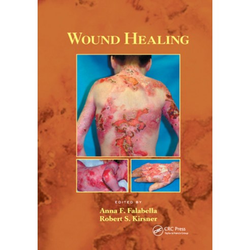 (영문도서) Wound Healing Paperback, CRC Press, English, 9780367392338