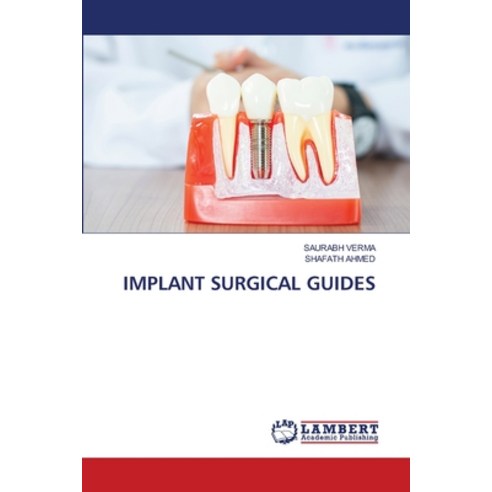 (영문도서) Implant Surgical Guides Paperback, LAP Lambert Academic Publis..., English, 9786207648351