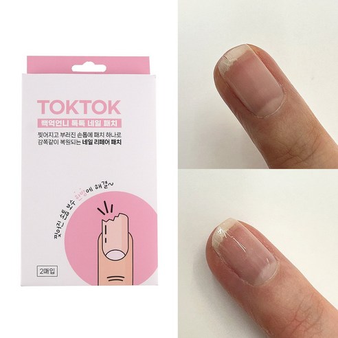 찢어진 손톱, 톡톡패치 하나로 쉽고 완벽하게!