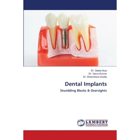 Dental Implants Paperback, LAP Lambert Academic Publis..., English, 9786202803212