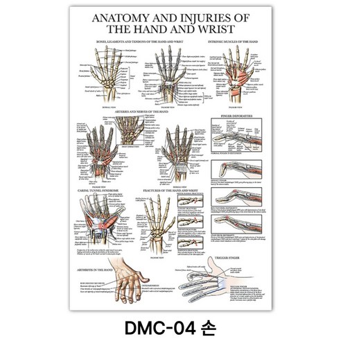 NEW 근육 해부학 포스터, DMC-04 손
