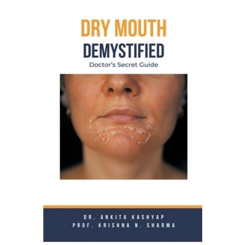 (영문도서) Dry mouth Demystified: Doctor''s Secret Guide Paperback, Virtued Press, English, 9798223545644